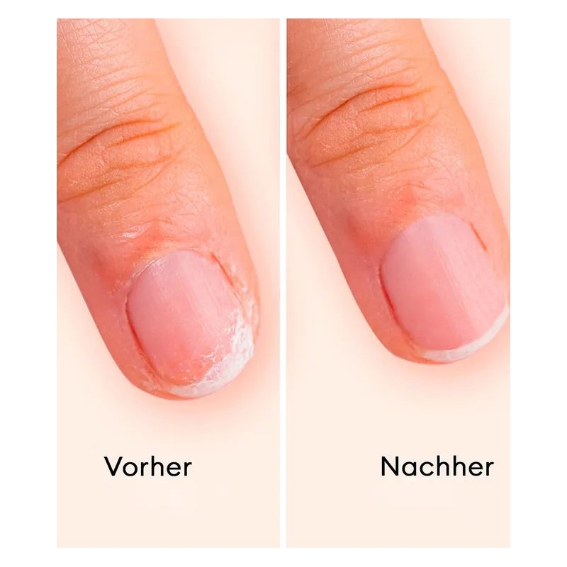 Trousse vernis à ongles | All about jellies (copie)