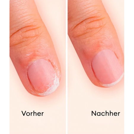 Trousse vernis à ongles | All about jellies (copie)